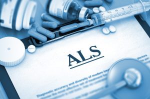 Senior Care in Monroe NJ: Changes Caused by ALS